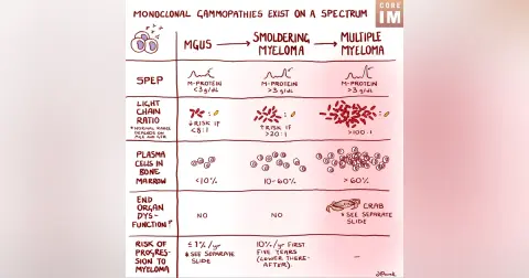 #169 MGUS to Multiple Myeloma Diagnostics and Counseling: 5 Pearls Segment