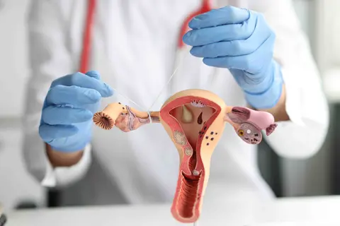 Tubal Ligation