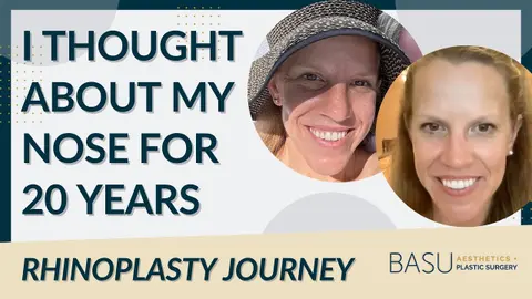 I Thought About My Nose for 20 Years - Andrea’s Rhinoplasty