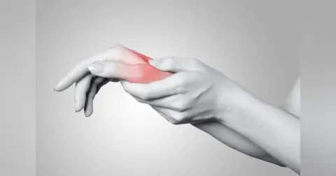 De Quervain’s Tenosynovitis