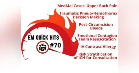 EM Quick Hits 70 MedMal Cases Upper Back Pain, Traumatic Pneumothorax/Hemothorax Decision Making, Risk Stratification of ICH for Consultation, Post-Circumcision Bleeds, IV Contrast Allergy, Emotional Contagion