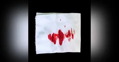 Rectal Bleeding