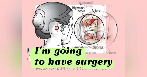 I'm going to have micro vascular decompression surgery (MVD)