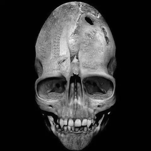 Skulls: Human or Alien