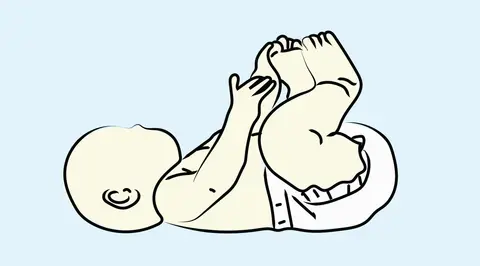 Pectus Deformities