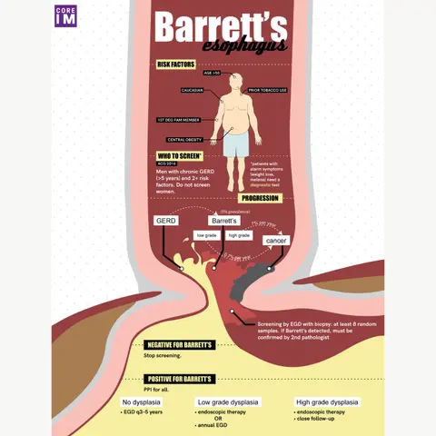 #33 Barrett's Esophagus: 5 Pearls