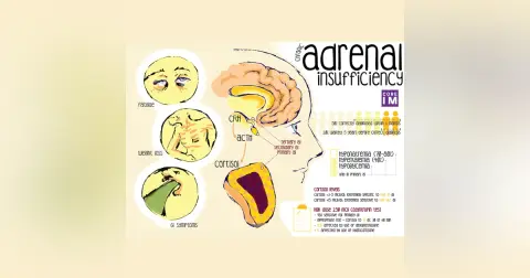 #13 Chronic Adrenal Insufficiency: 5 Pearls segment