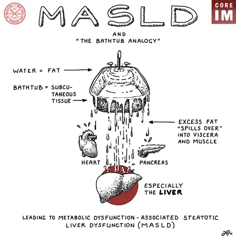 #211  Breaking Down MASLD vs. MASH and the MAESTRO-NASH & ESSENCE Trials: Beyond Journal Club Segment