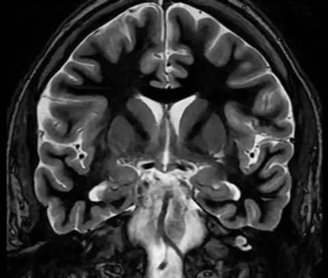Episode 36 MRI of the Central Nervous System