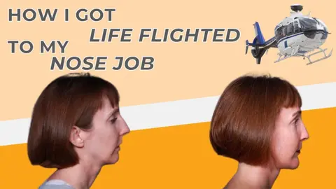 Patient Kathleen: How I Got Life Flighted To My Nose Job