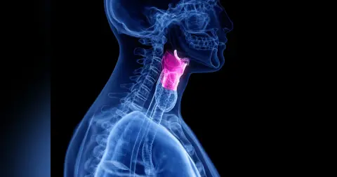 Vocal Fold Paralysis