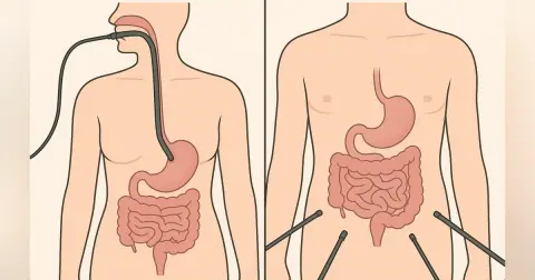 Endoscopy vs Laparoscopy and the Beginnings