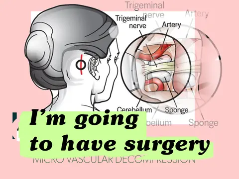 I'm going to have micro vascular decompression surgery (MVD)