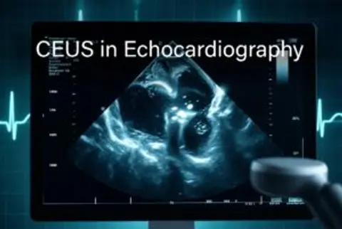 Episode 43 CEUS in Echocardiography