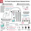 #186 Pneumothorax: 5 Pearls Segment