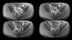 Episode 30: Body MRI