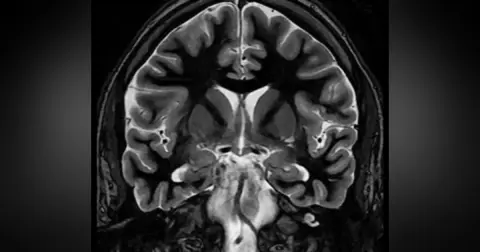 Episode 36 MRI of the Central Nervous System