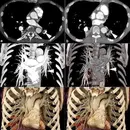 Cinematic rendering - an interview with Dr Steven Rowe and Dr Elliot FIshman