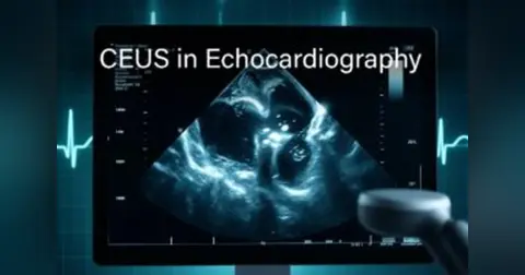 Episode 43 CEUS in Echocardiography
