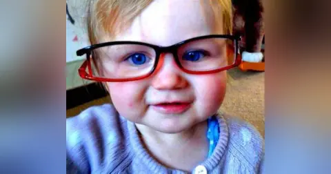 Nearsightedness