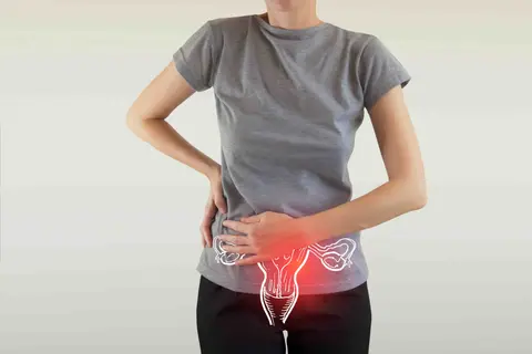 Hysterectomy