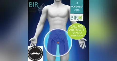 Prostate cancer commentary