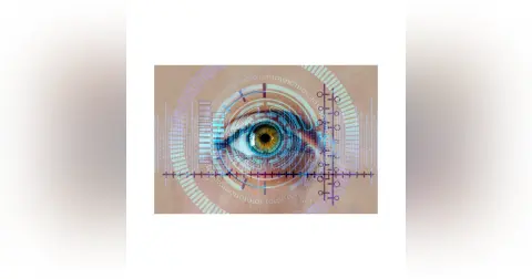 Glaucoma