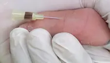 Pediatric Electrolyte Emergencies