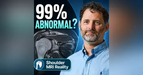 Dr. Thomas Ibounig on Incidental Rotator Cuff Abnormalities and Shoulder MRI