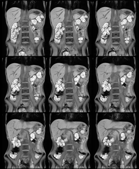 Episode 41 Body MRI Update