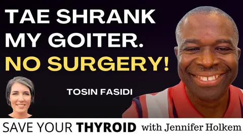 Escaping the Sternotomy: How Tosin Found a Non-Surgical Answer for a Massive Goiter