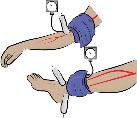 Examination of the Peripheral Pulses