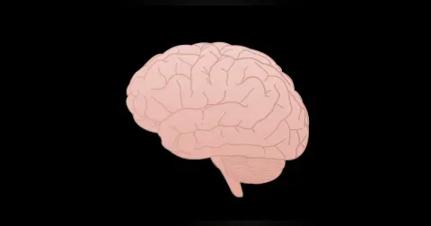 Intracranial Aneurysms