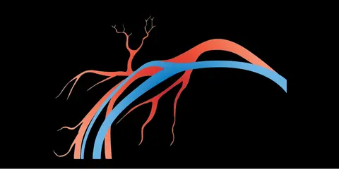 Pulmonary Embolisms and Deep Vein Thrombosis