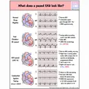 #140 Bonus Pacemaker & ICDs: 5 Pearls Segment