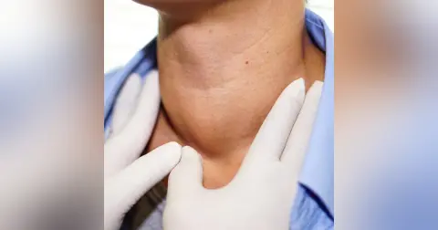 Thyroid Emergencies