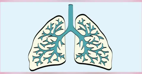 Solitary Pulmonary Nodule