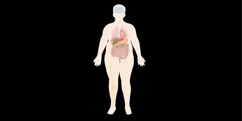 Medical Management of Obesity