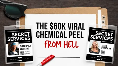 The $60k Viral Chemical Peel From Hell