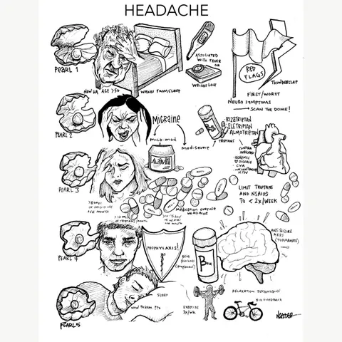 Core IM Podcast: 5 pearls on Headaches - Core IM | Internal Medicine | Medical Education | FOAMed | Family Medicine | Physician Assistant | Resident | Nurse Practitioner | Medical Student | Hospitalist | Primary Care