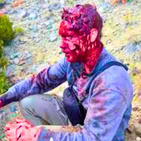 I was mauled by a bear and I fought it off. Ask Me Anything!
