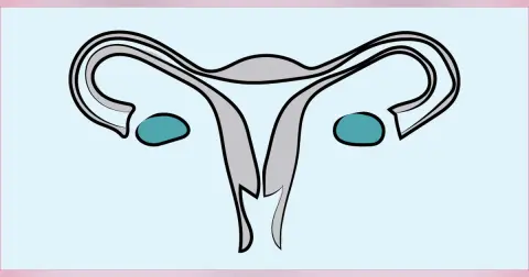 Abnormal Uterine Bleeding