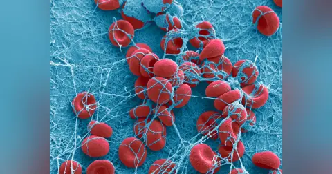Episode 61 - Abnormal Uterine Bleeding