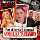 Glam Model Has Part of Skull Removed After Attack From Her Millionaire Boyfriend.. ANZHELIKA TARTANOVA