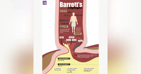 #33 Barrett's Esophagus: 5 Pearls