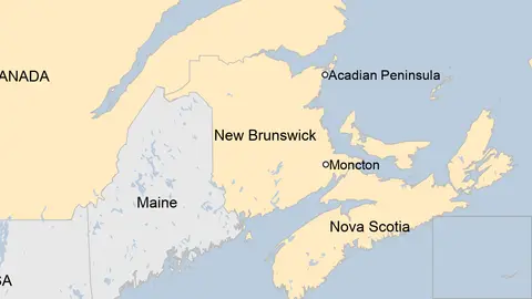 Canada’s mysterious brain disease.