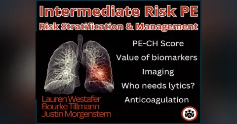 Ep 203 Intermediate Risk Pulmonary Embolism Risk Stratification, Management and Algorithm