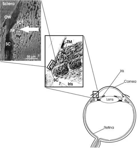 Ep 23 Talking About Glaucoma - 3Nov2014: ab-interno trabecular bypass surgery (mp3 version)