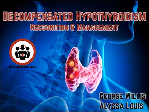 Ep 210 Decompensated Hypothyroidism Recognition and Management