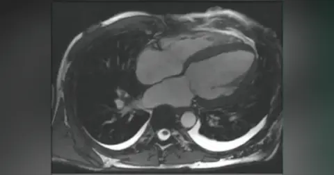 Episode 31: Cardiac MRI Update